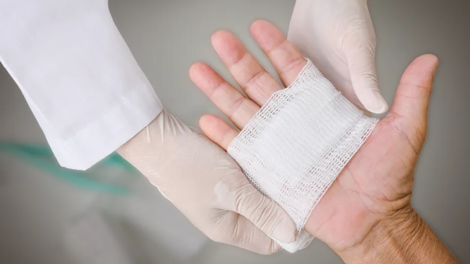 Luka Diabetes Sulit Sembuh Saat Cuaca Ekstrem Oktober: Penyebab dan Perawatan