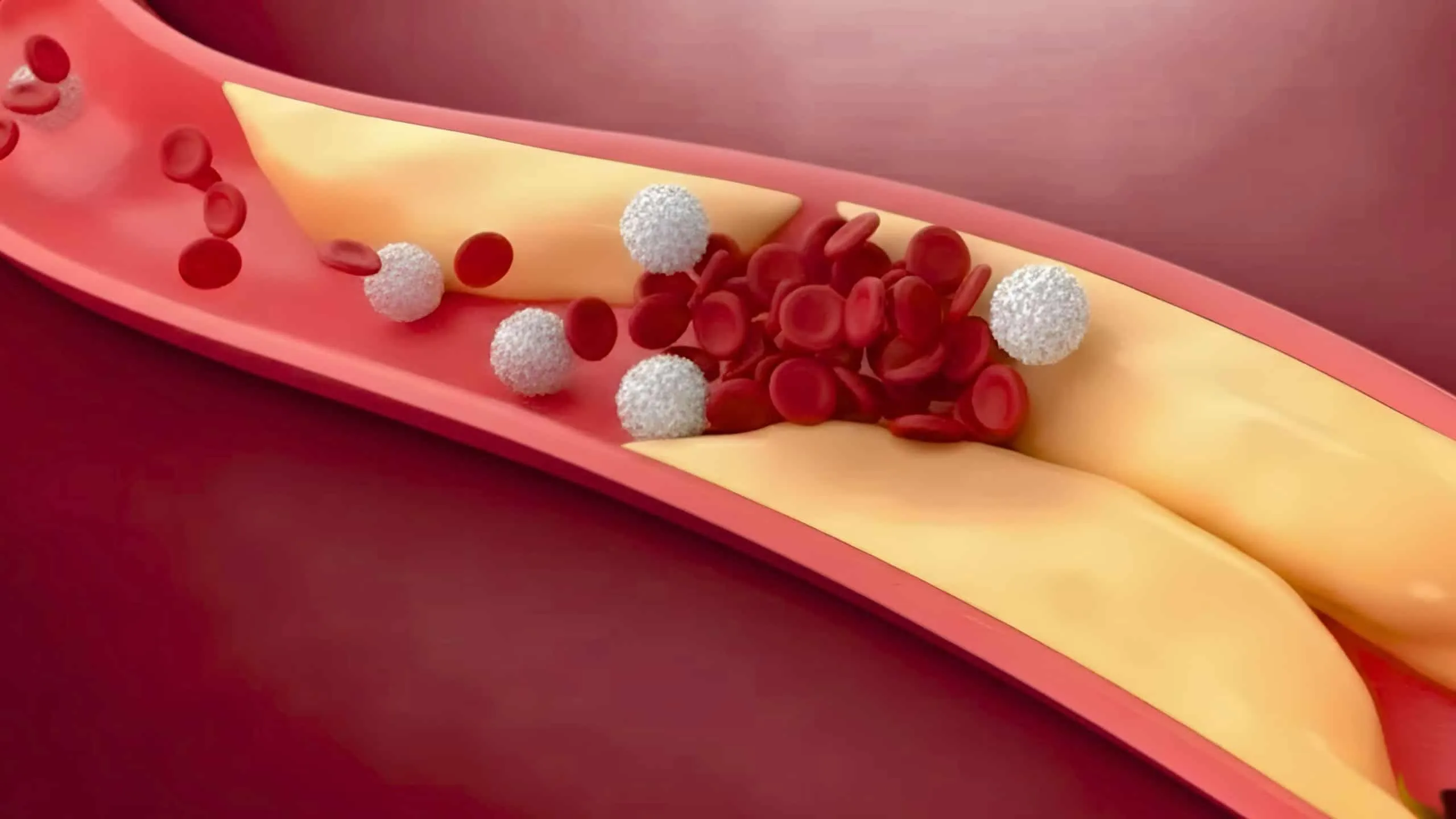 Luka Diabetes: Penyebab dan Cara Penanganannya